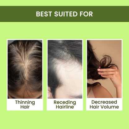 Original Rosemary Water, Hair Spray For Regrowth Buy 1 Get 2 Free (Pack of 3)