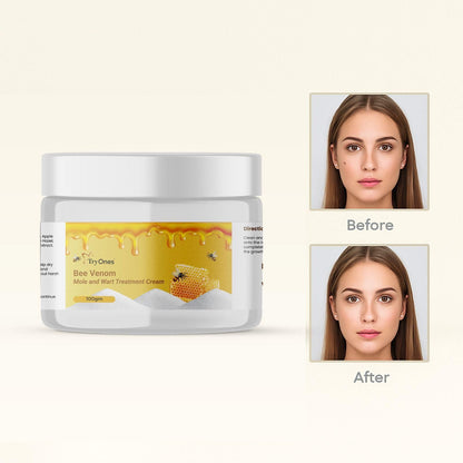 Bee Venom Mole and Wart Treatment Cream 200 gm Pack of 2